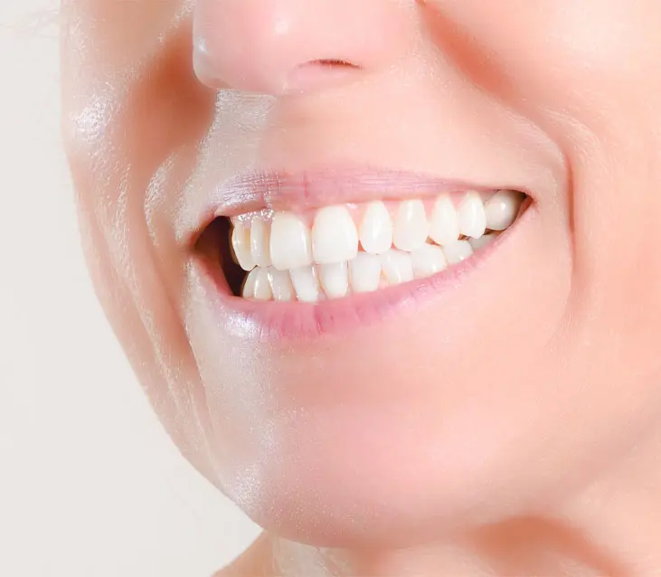 https://faceteethsmile.com/wp-content/uploads/2022/01/FTS-Cosmetic_Dentures-Second_Image.jpg
