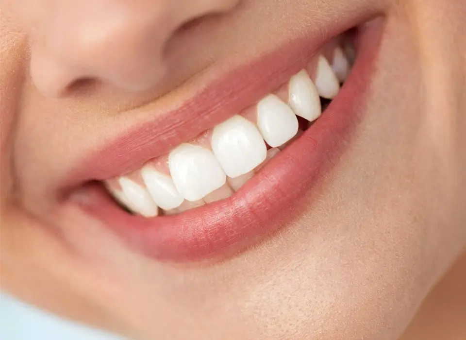 Teeth Whitening Buckinghamshire