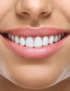 White spot removal treatment Chalfont St Peter