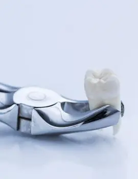 Tooth Extraction Chalfont St Peter - Gerrards Cross - Face Teeth Smile