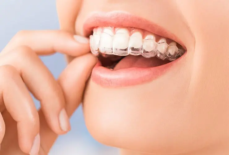 Teeth Straightening Gerrards Cross