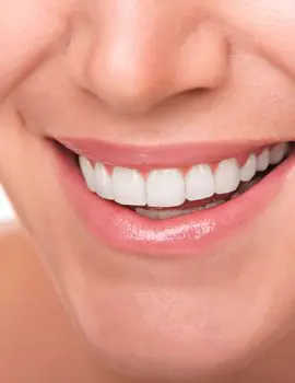 veneers package