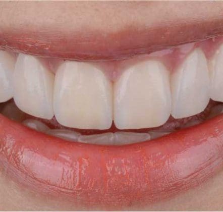 Autumn Superfood Could Give Your Smile a Boost