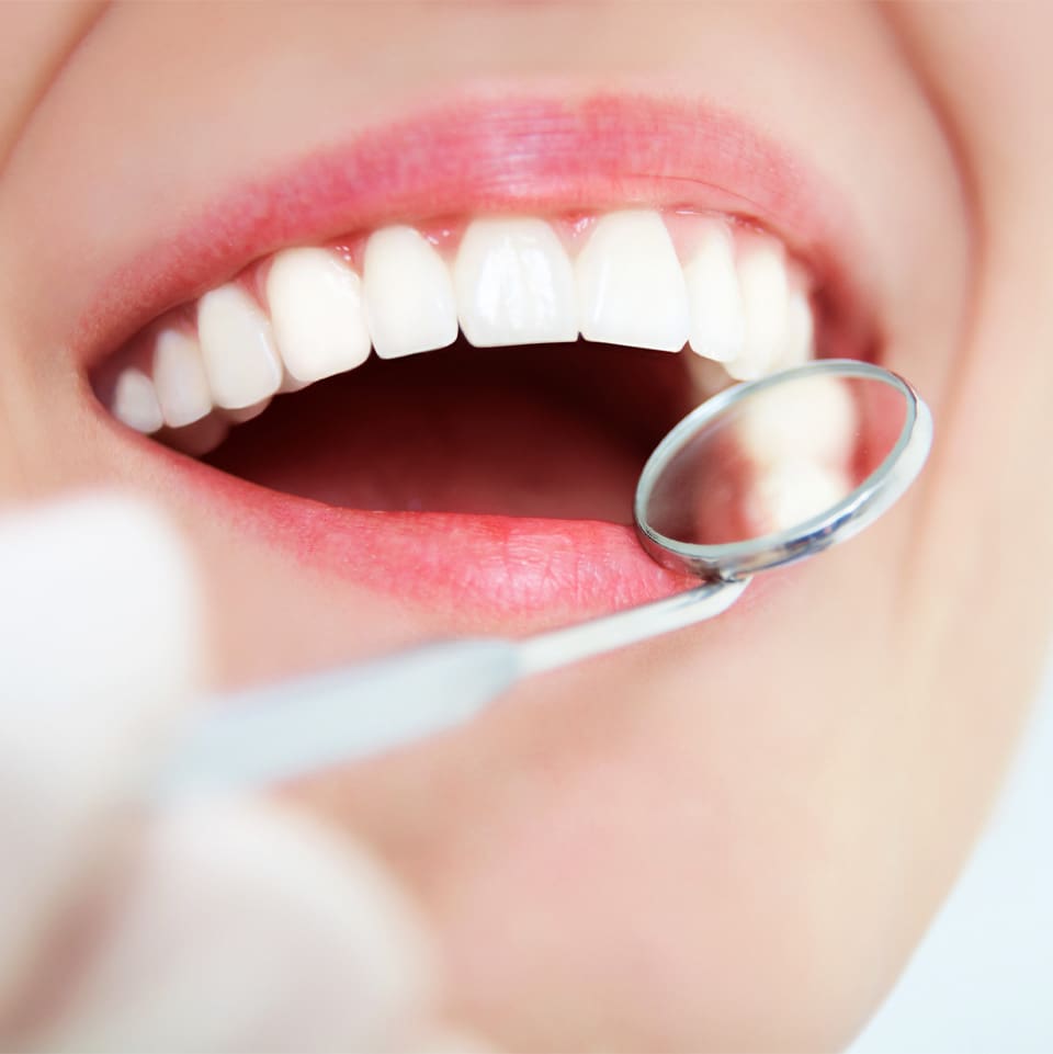 Dental Hygienist Gerrards Cross