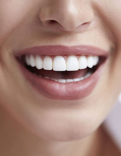 FTS-Invisalign__Composite_Veneers-Hero-1.jpgThumb