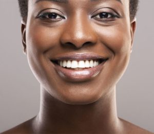 Veneers After Invisalign