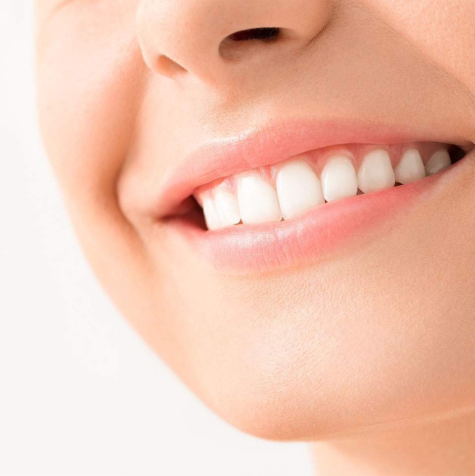 Laser Gum Contouring Chalfont St Peter - Gerrards Cross - Face Teeth Smile