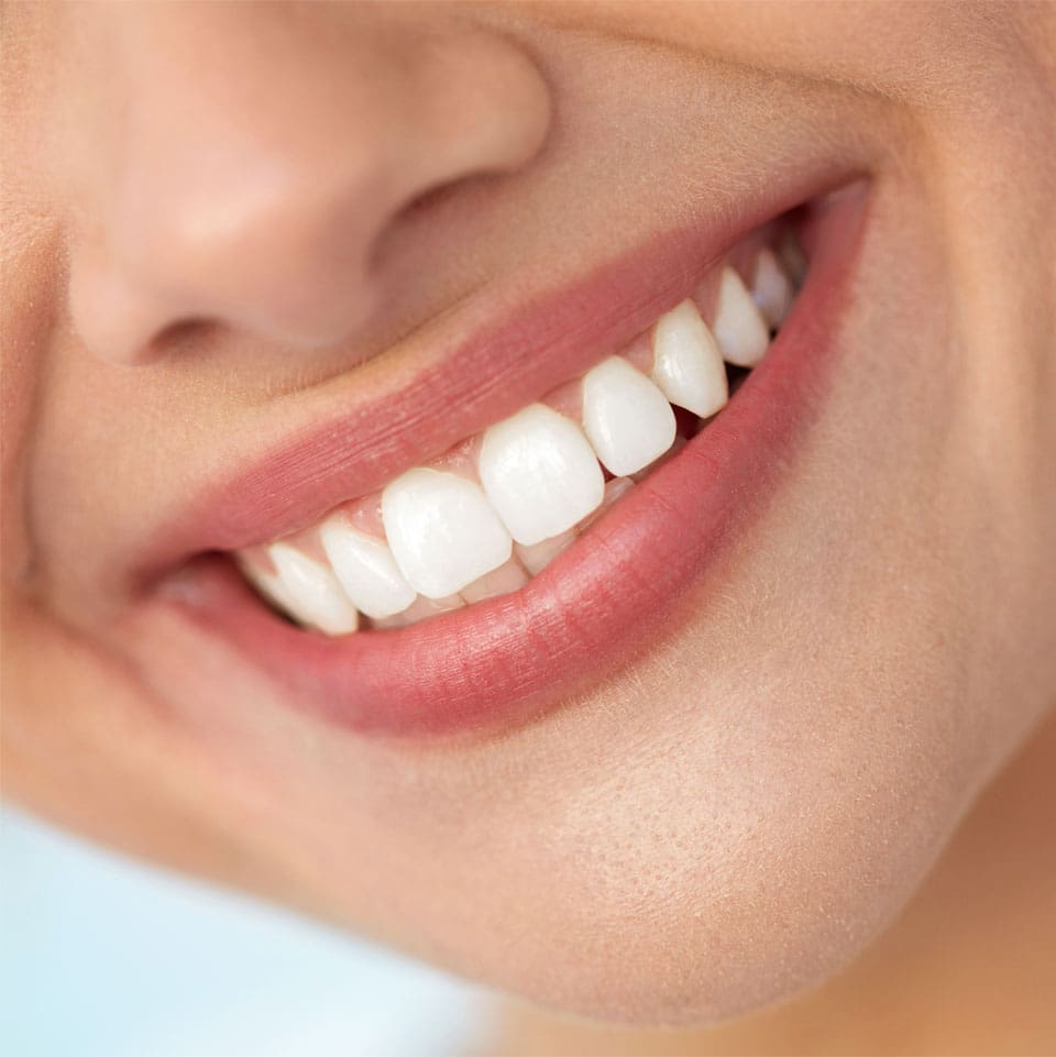 Teeth Whitening Buckinghamshire