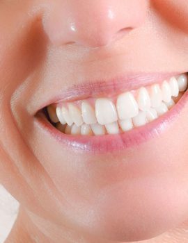 Cosmetic Dentures Chalfont St Peter - Gerrards Cross - Face Teeth Smile