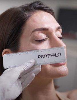 Profhilo skinbooster Chalfont St Peter