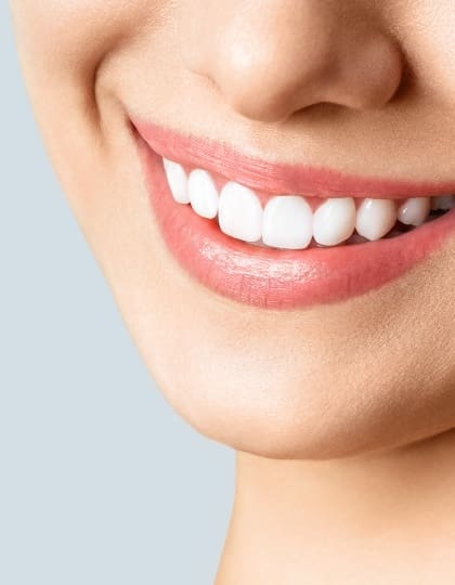 White Fillings Chalfont St Peter - Gerrards Cross - Face Teeth Smile