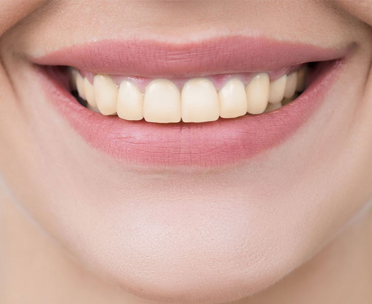 https://faceteethsmile.com/wp-content/uploads/2022/02/FTS-Discoloured_Teeth-Section3-1.jpg
