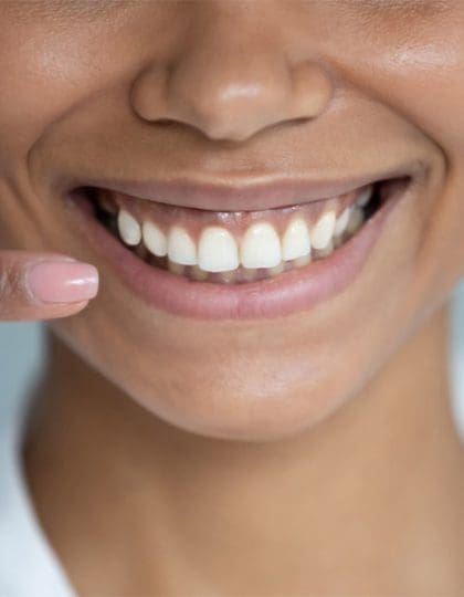 10 Tips For Healthy Teeth And Perfect Smiles
