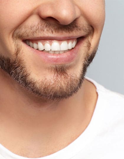 FTS-Gummy_Smile-Thumbnail