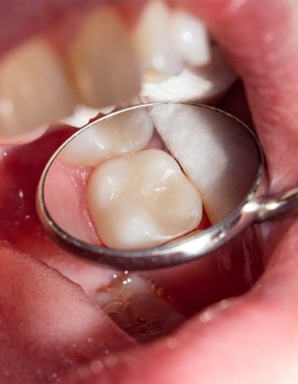 How To Guarantee Good Oral Health For Children