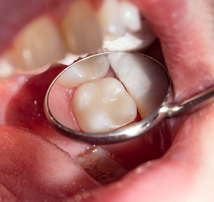 How To Guarantee Good Oral Health For Children