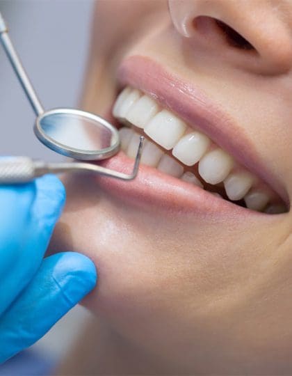 5 Unexpected Bad Habits That Could be Damaging your Teeth
