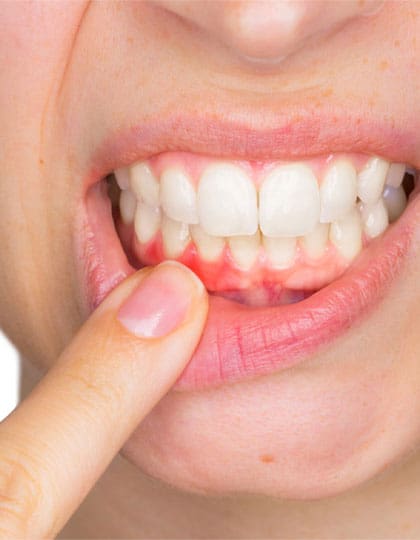 Periodontist Gerrards Cross