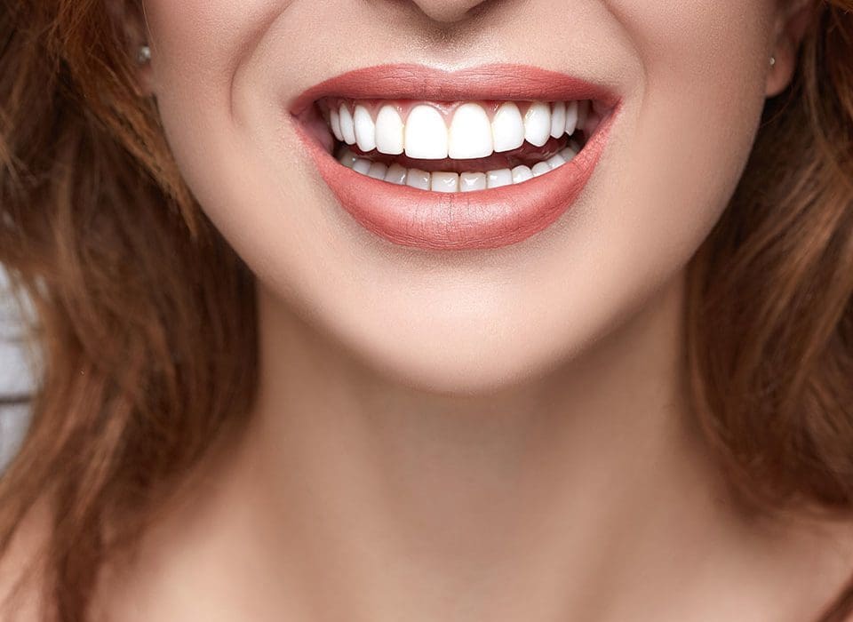 Composite Bonding Package