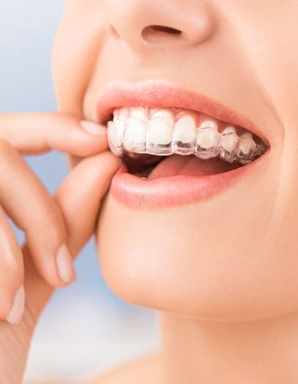 How can Invisalign clear aligners straighten your smile?