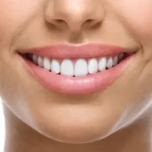 what are the main benefits of porcelain veneers