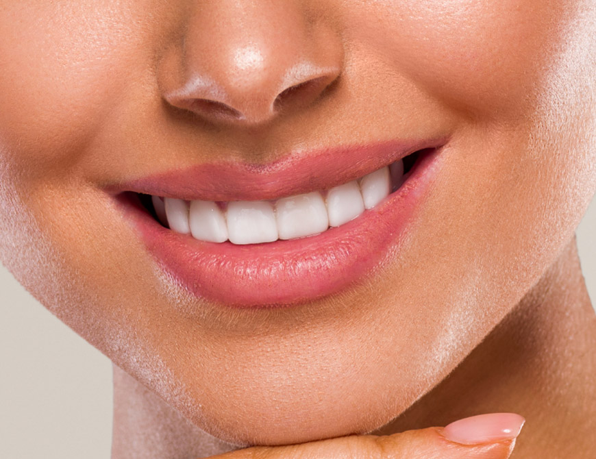 Transform Your Smile With Veneers Rickmansworth